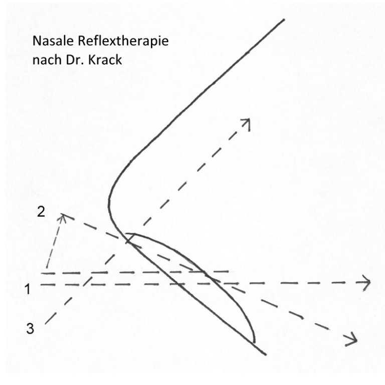 Seminar Nasale Reflextherapie nach Dr. Krack